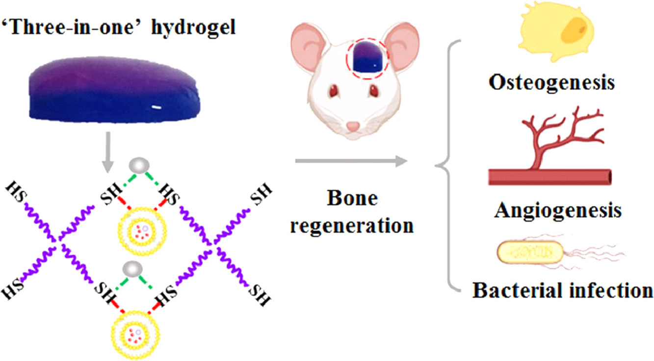a “tres en uno” plataforma de hidrogel inyectable con osteogénesis, angiogénesis y antibacteriano para guiar la regeneración ósea